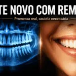 Regeneração dentária por medicamento avança no Japão, mas ainda pede cautela